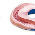 Copy Technique for Complete Dentures