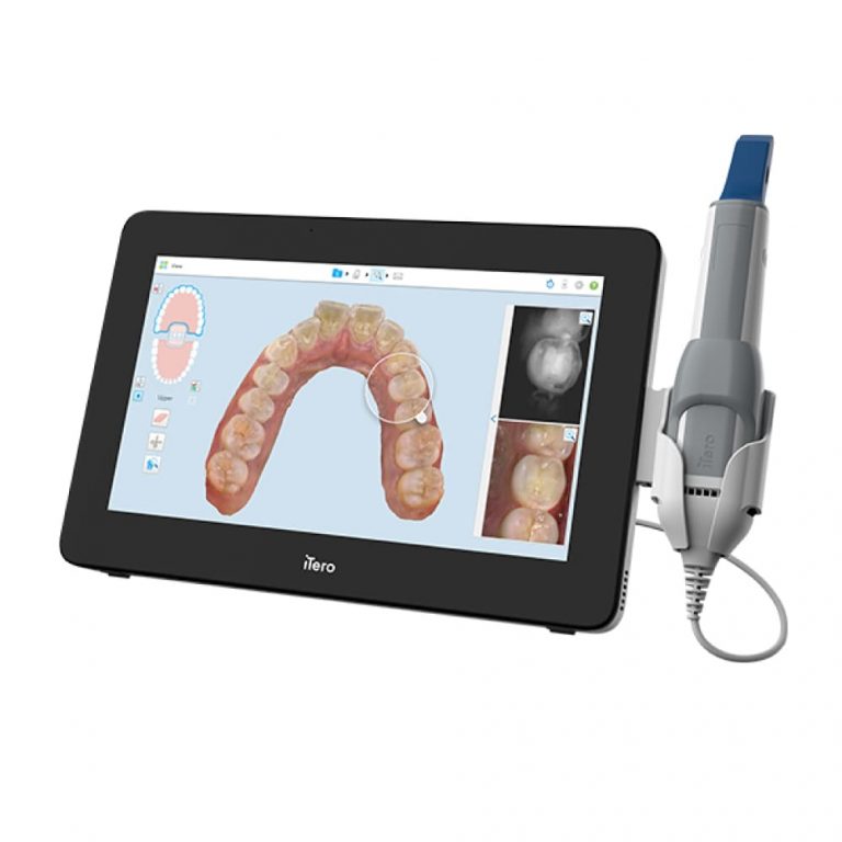 iTero Element 5D Plus Cart | MediMatch Dental Laboratory