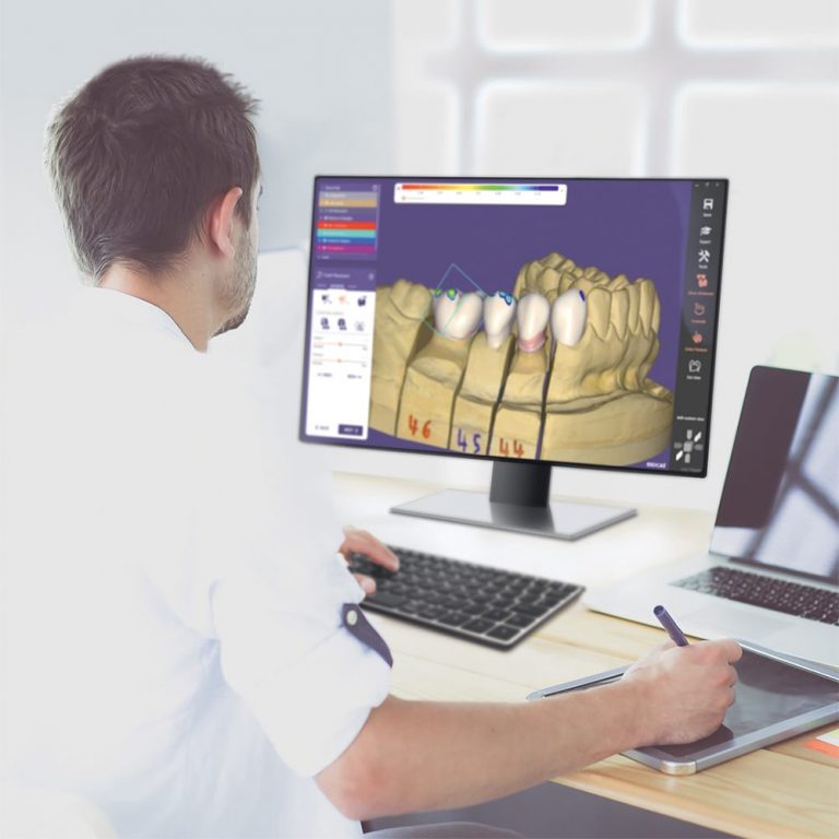 Exocad ChairsideCAD Ultimate Bundle | MediMatch Dental Laboratory