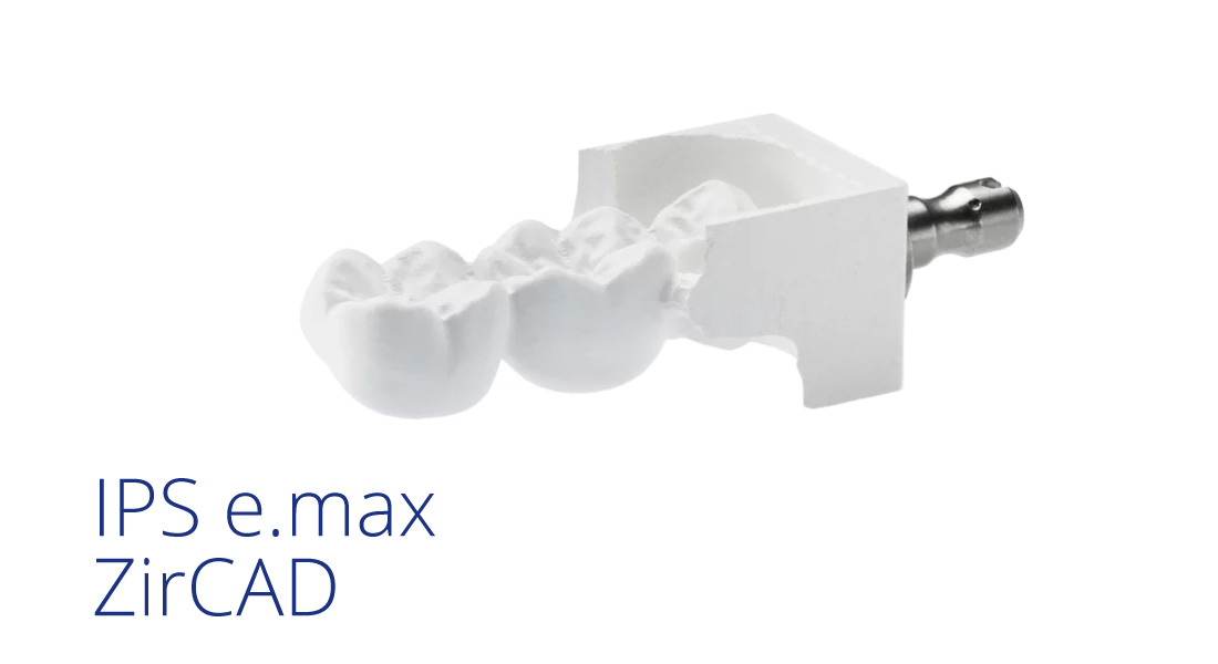 Discover cementation by Ivoclar MediMatch Dental Laboratory