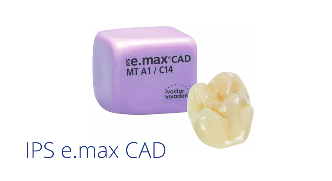 Discover cementation by Ivoclar MediMatch Dental Laboratory