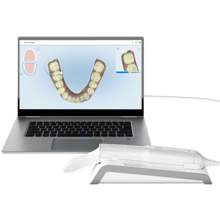 ITero Element Flex | MediMatch Dental Laboratory