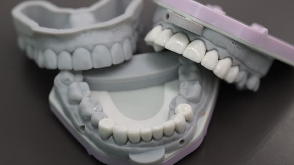 PMMA restorations for large upper and lower case