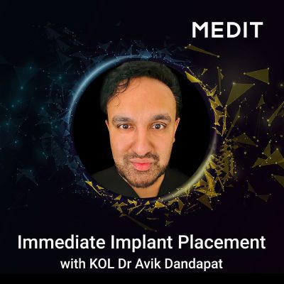 immediate-implant-placement