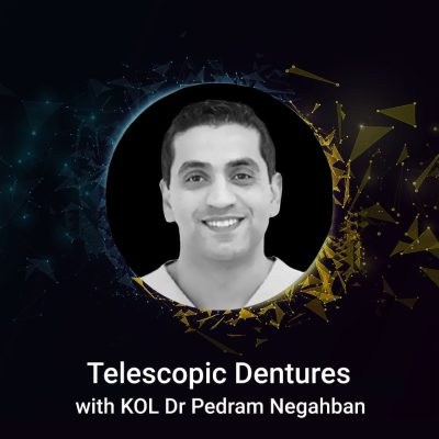 telescopic-dentures-dr-pedram-negahban