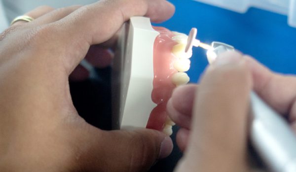 GC Composite Injection Protocol | MediMatch Dental Laboratory