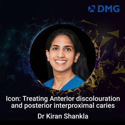 icon-treating-anterior-discolouration-and-posterior-interproximal-caries