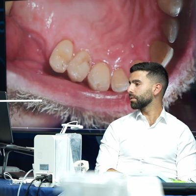 posterior-dentistry-with-dr-hassan-asad