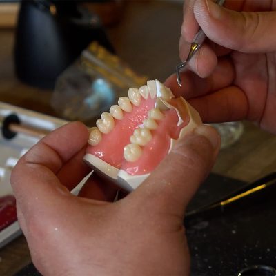 Composite Veneers Masterclass - Image 6