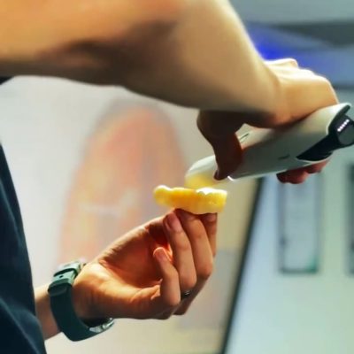 Mastering Copy Dentures with Trios - Image 4