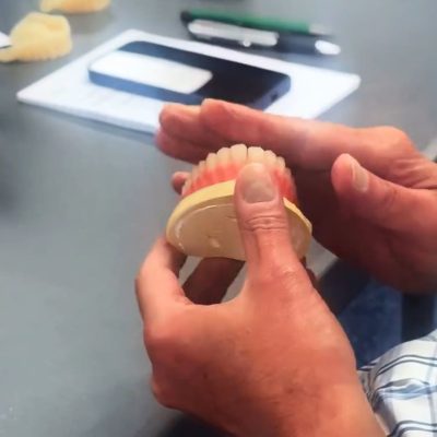 Mastering Copy Dentures with Trios - Image 3