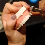 free-hand-veneers-course