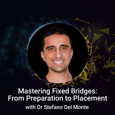 Mastering Fixed Bridges: From Preparation to Placement