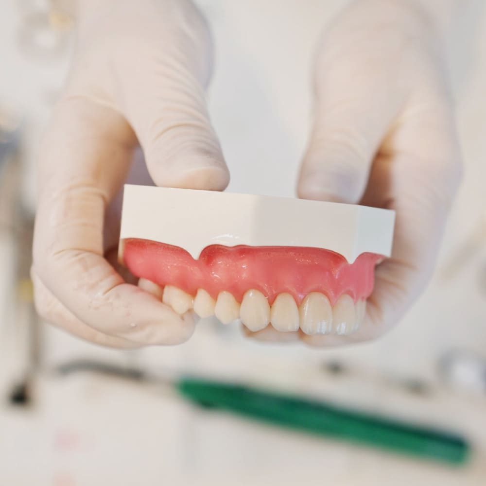 Porcelain Veneers - Image 3 Porcelain Veneers - Image 3