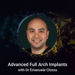 Advanced Full Arch Implants